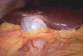 gastroenterologist in nashik